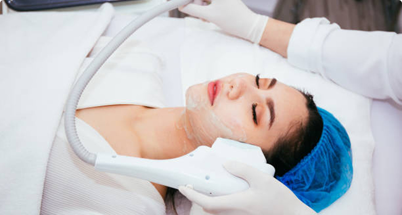 Mengenal Pico Laser: Solusi Modern untuk Flek dan Bekas Jerawat