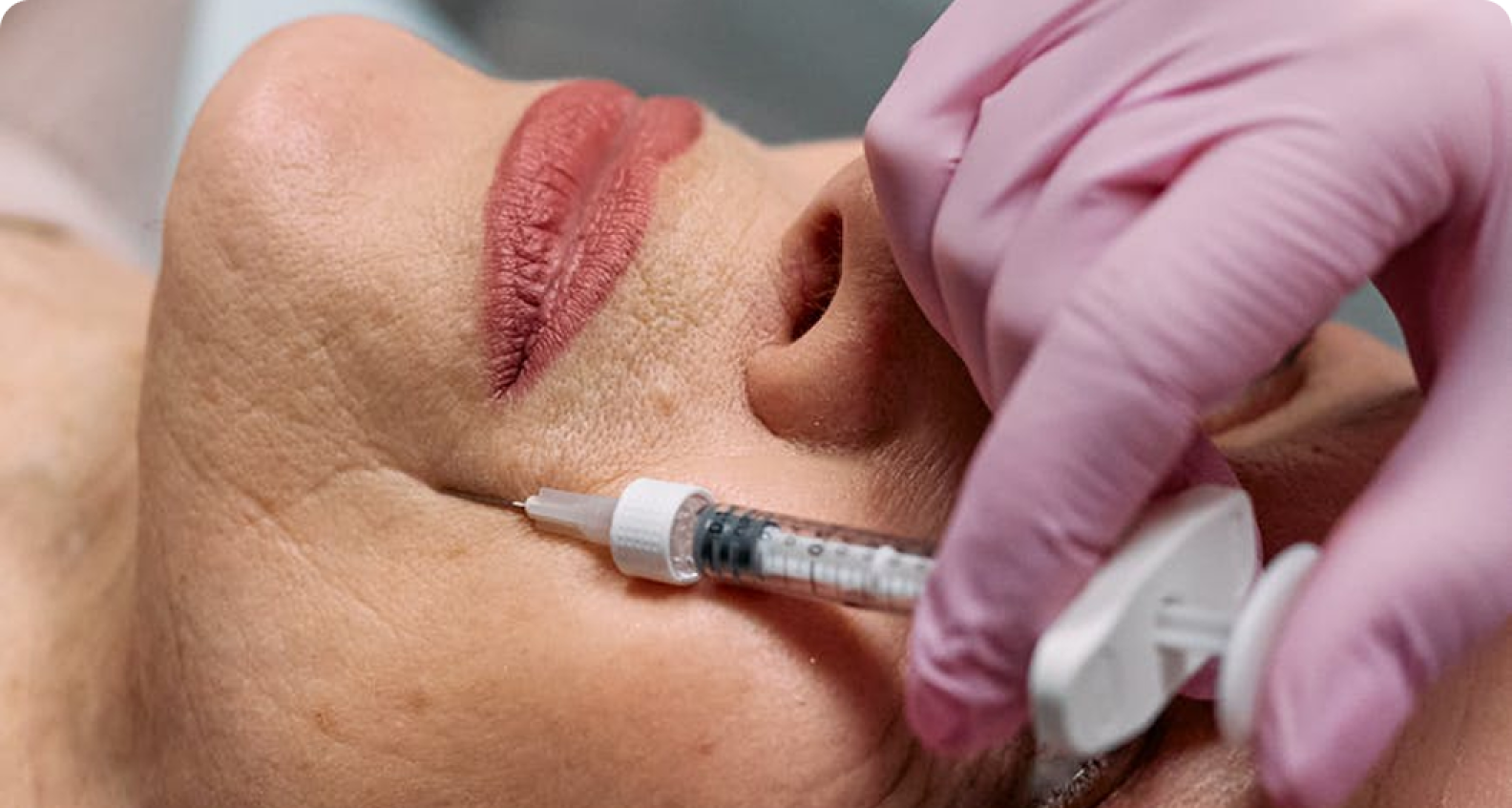 Botox vs Filler: Apa Bedanya dan Kapan Sebaiknya Digunakan?