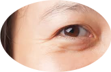 Kantung Mata